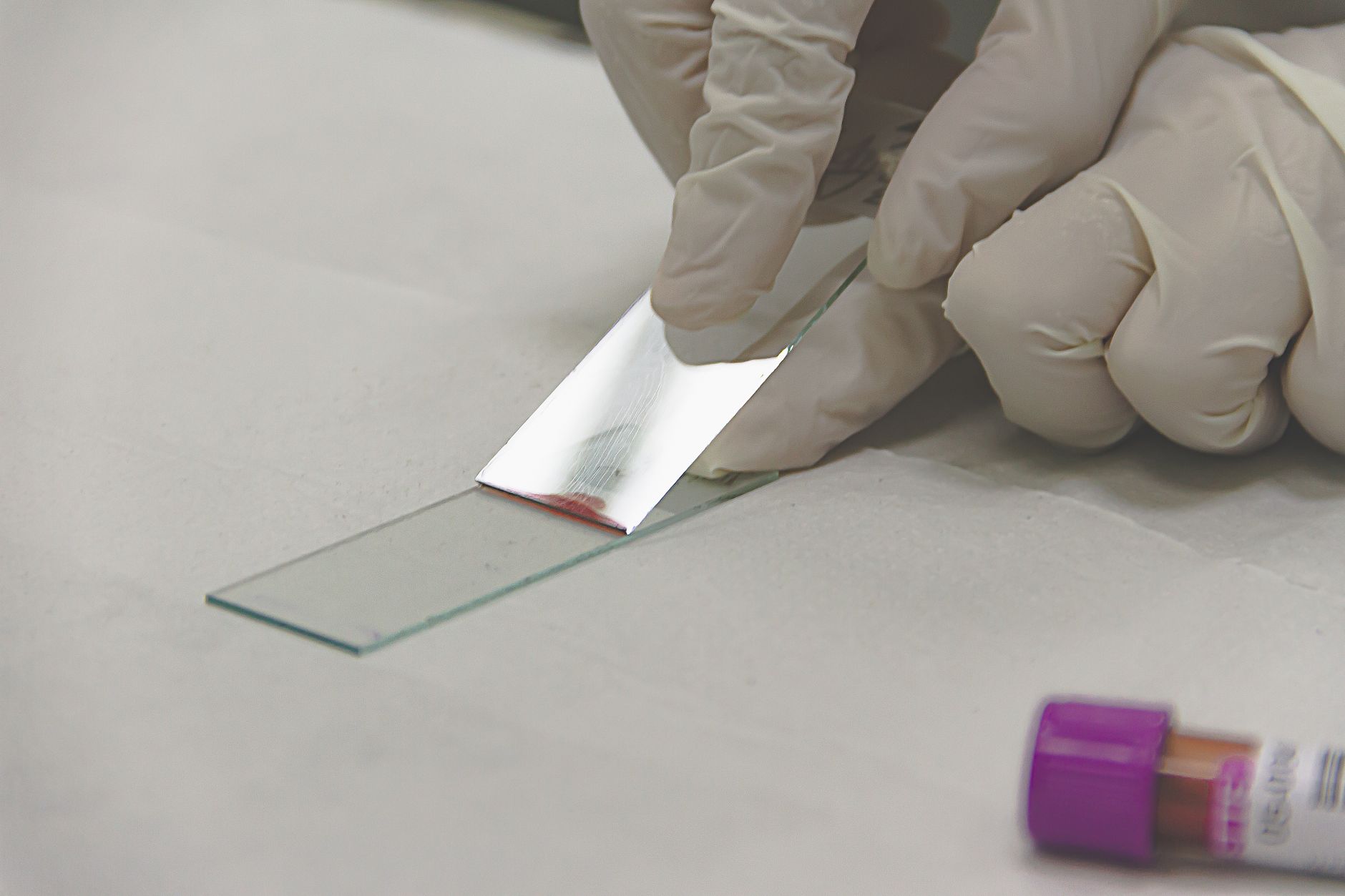 Blood sample tubes prepared for laboratory analysis