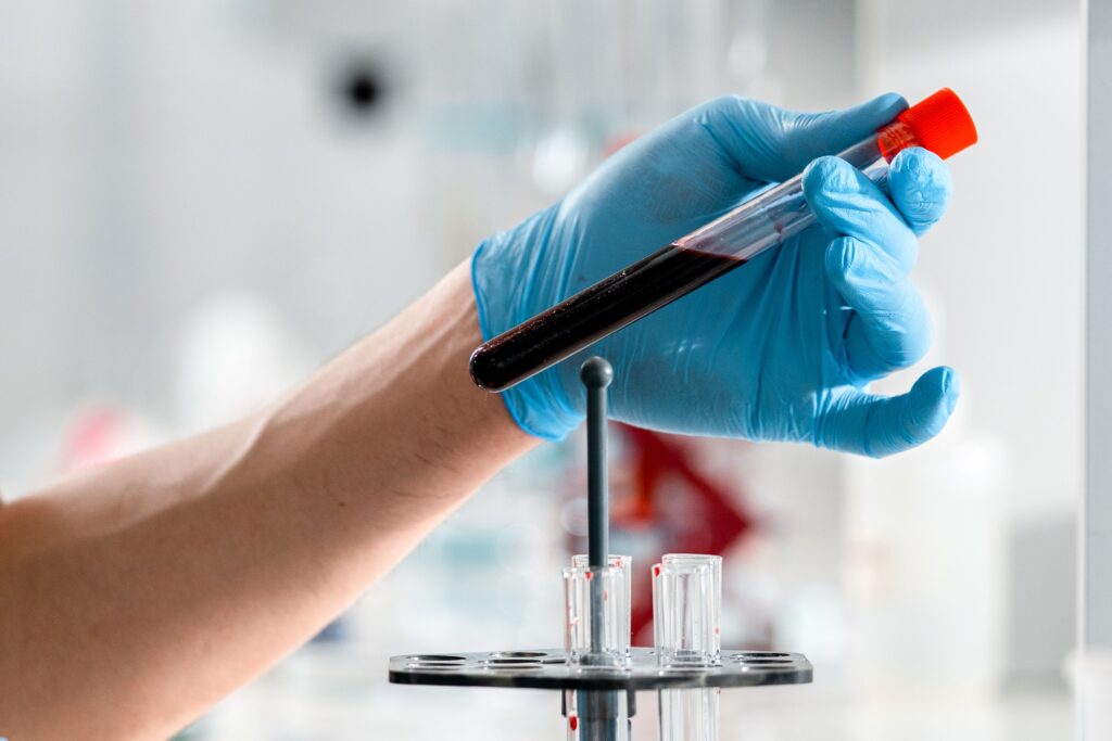 elevated bilirubin in ferrets liver or hemolytic issues
